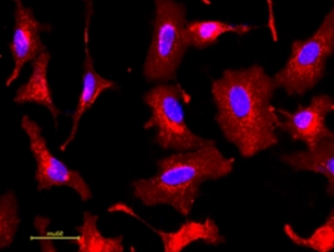 FITC-WFA荧光素标记紫藤凝集素(WFA,WFL),Fluorescein labeled Wisteria Floribunda Lectin (WFA, WFL) FITC-WFA荧光素标记紫藤凝集素(WFA,WFL),Fluorescein labeled Wisteria Floribunda Lectin (WFA, WFL)