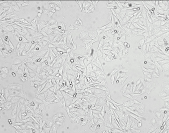 saos2骨肉瘤细胞膜复合纳米脂质体 saos2骨肉瘤细胞膜复合纳米脂质体