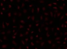 荧光修饰响应型造影脂质体定制技术（Fluorescently Labeled Stimuli-Responsive Imaging Liposome Customization Technology）